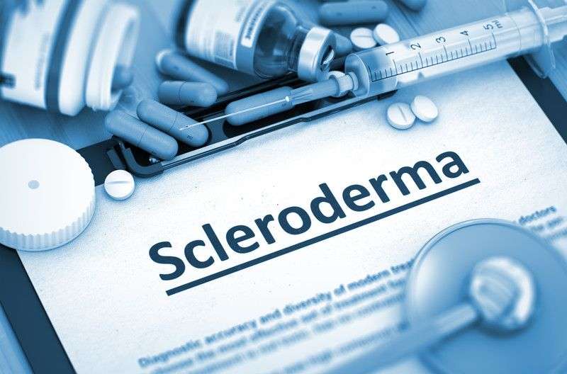 scleroderma