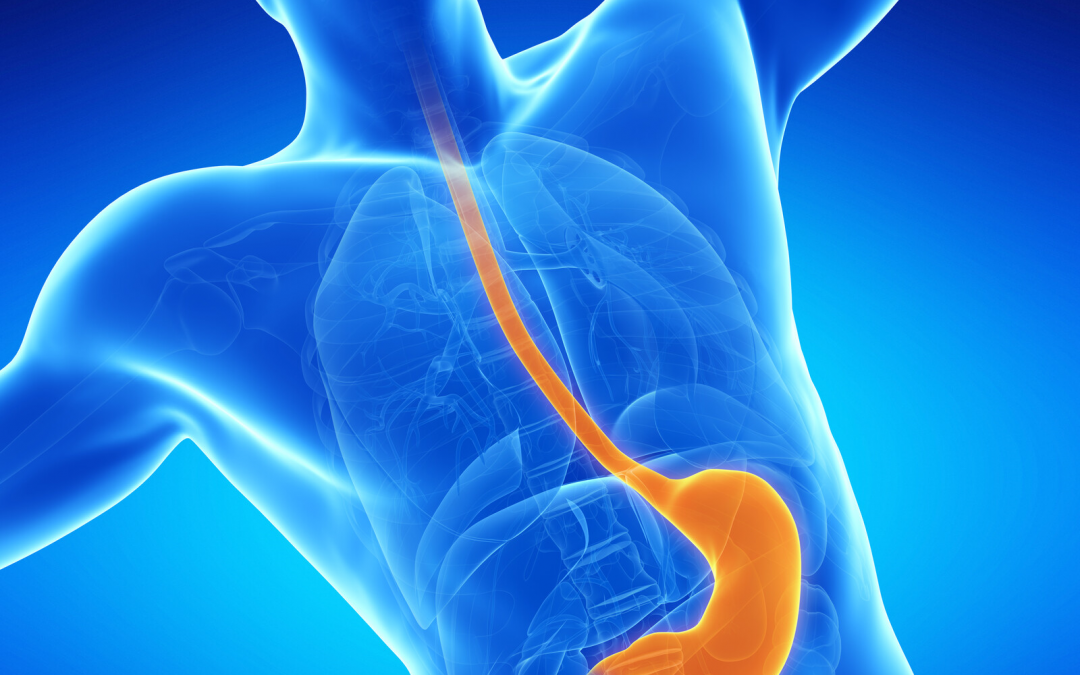 acid reflux oesophagus