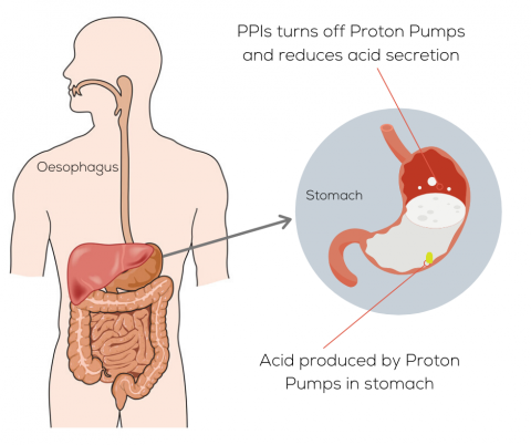 Proton Pump Inhibitors (PPIs) Explained // A Peptest informational blog