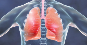 Lungs