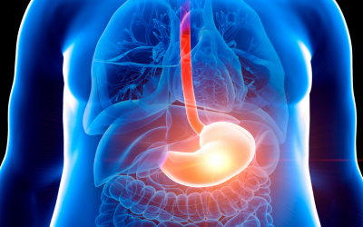 What Happens After Barrett’s Treatment? Study Reveals Best Way to Prevent Recurrence
