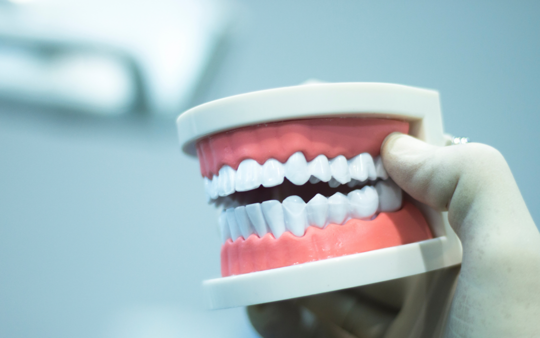 Gums PPIs