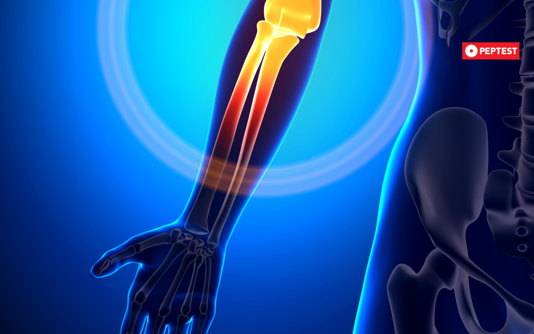 arthritis