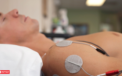 Study Investigates Transcutaneous Electrical Stimulation for GERD Symptom Management